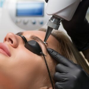 Eliminación de micropigmentaciones y microblading