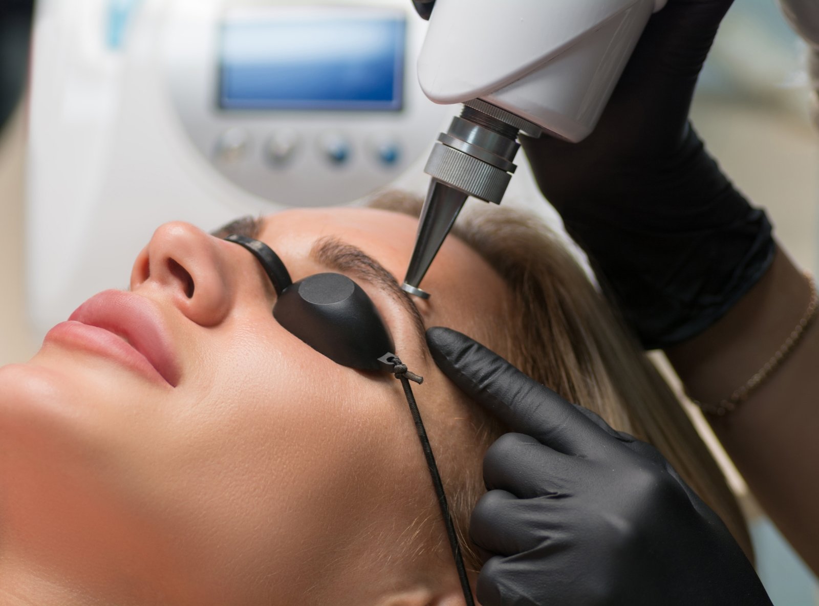 Eliminación de micropigmentaciones y microblading