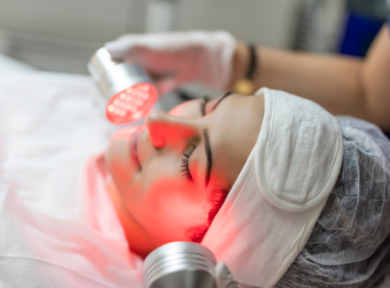 Endolifting facial