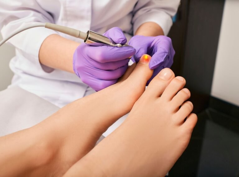 Onicomicosis